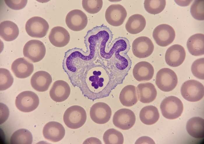 Anaplasma and Lyme Co‑infection Failure